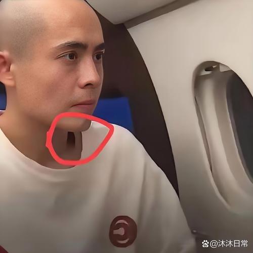 颈部有明显血痕！普理查德：训练营里的对抗像打仗一样