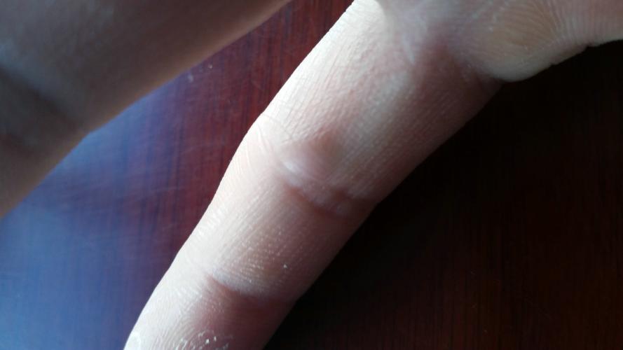 打广州可以出战！莱昂纳德-米勒右手小拇指割伤已恢复！